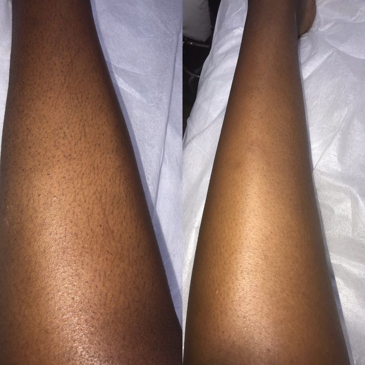 Before and After Waxing 2